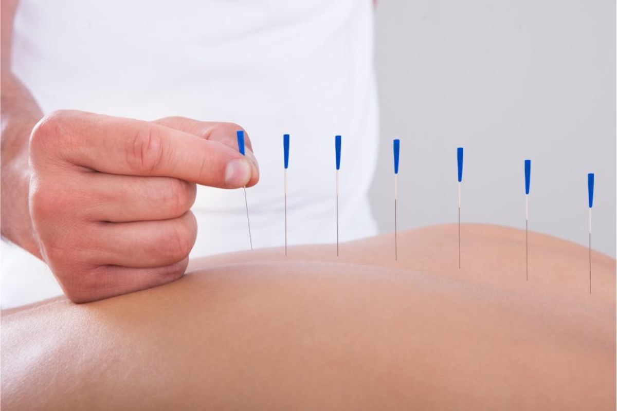 acupuncture fertility halifax