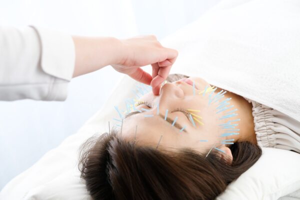 Where to Get Facial Rejuvenation Acupuncture Near Halifax
