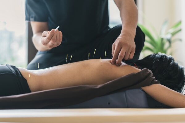 Fertility Naturally with Acupuncture in Bedford