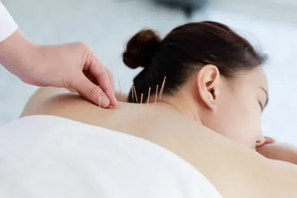 How Acupuncture Relieves Back Pain and Sciatica in Halifax