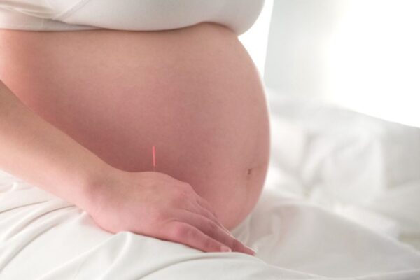 Pregnancy Acupuncture in Halifax