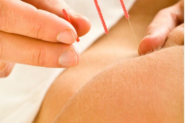 Balancing Hormones Naturally: How Our Acupuncture Services Support Menstrual Health in North End