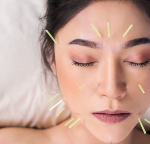 Facial Rejuvenation Acupuncture Halifax - Coastal Sports and Wellness