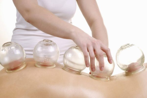 WHAT IS CUPPING?